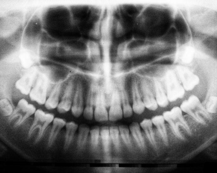 Photo Dental X-ray
