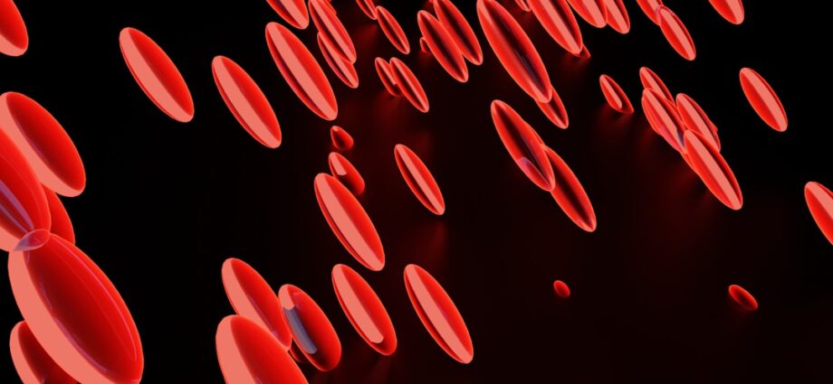 Photo varicose veins