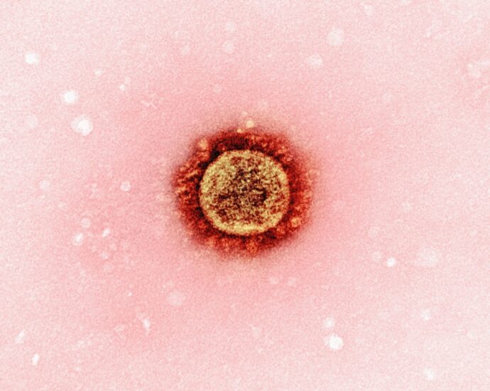 Photo Urinary Infection