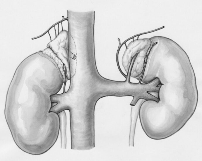 Photo detoxify kidneys