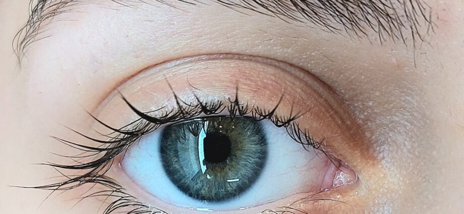 Photo natural treatment for dry and tired eyes