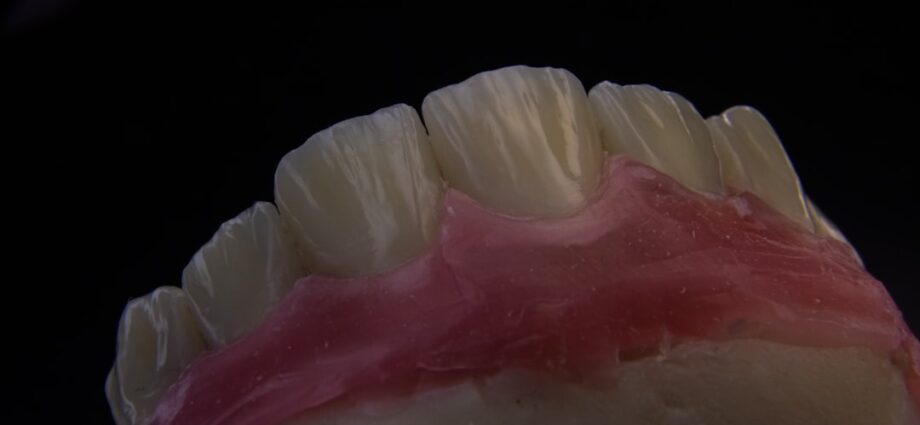 Photo herpes bucal