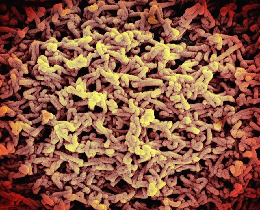 autoimmune diseases