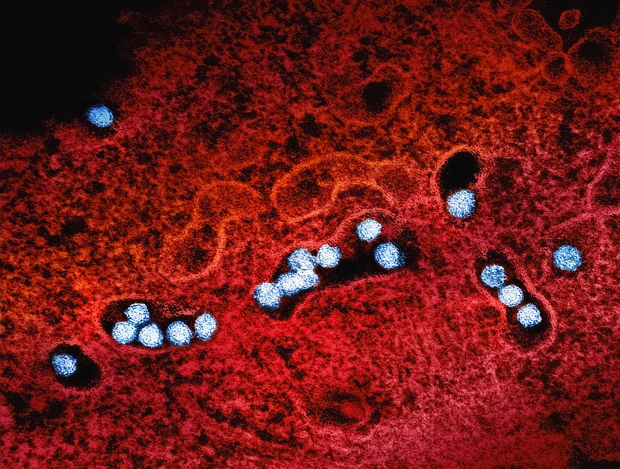 Photo autoimmune diseases