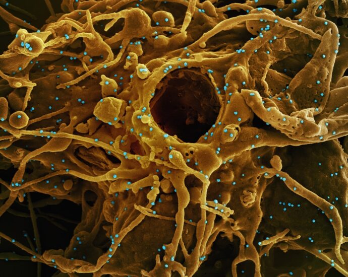 Photo autoimmune diseases