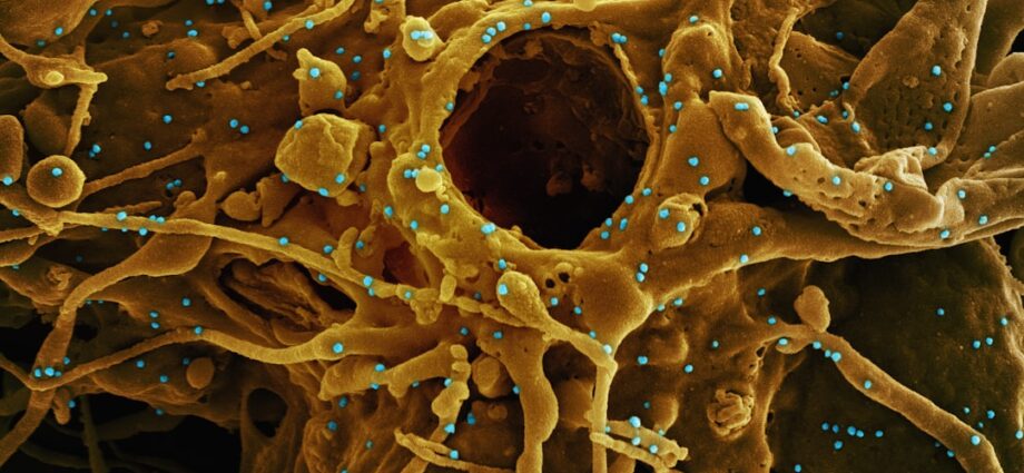 Photo autoimmune diseases