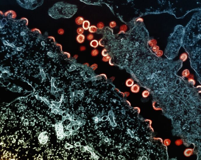 Photo inflammatory diseases