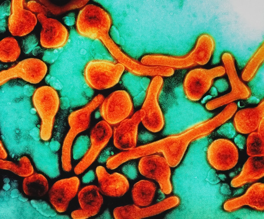 infections
