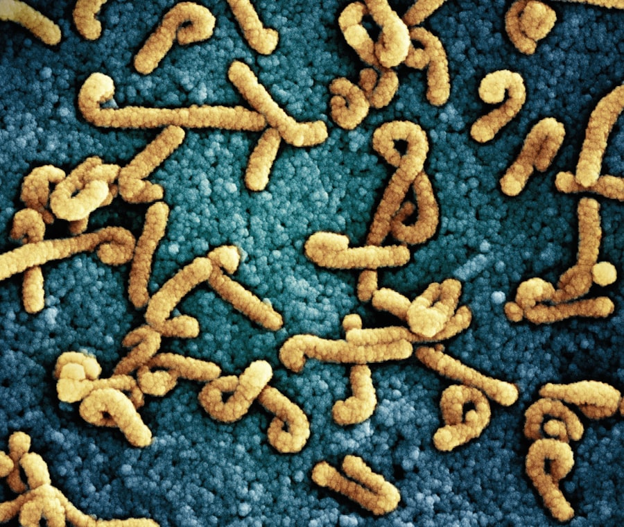 infectious diseases