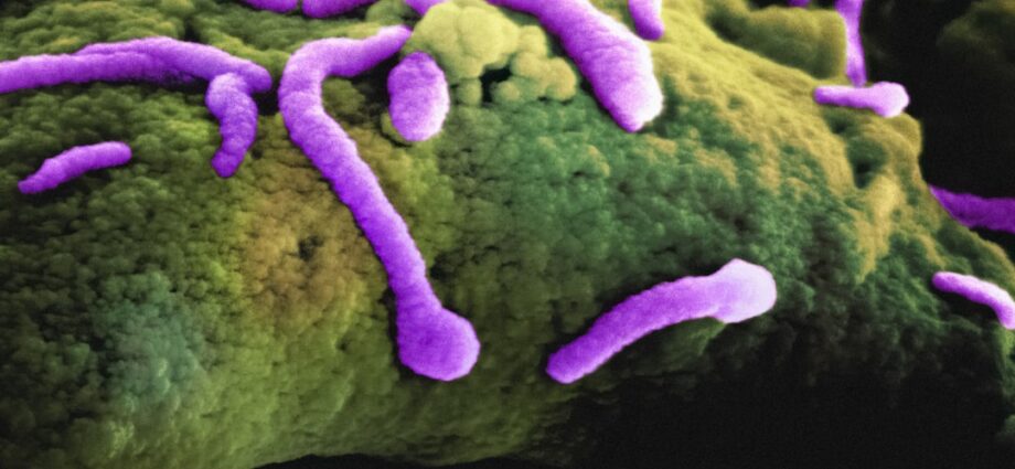 Photo infectious diseases