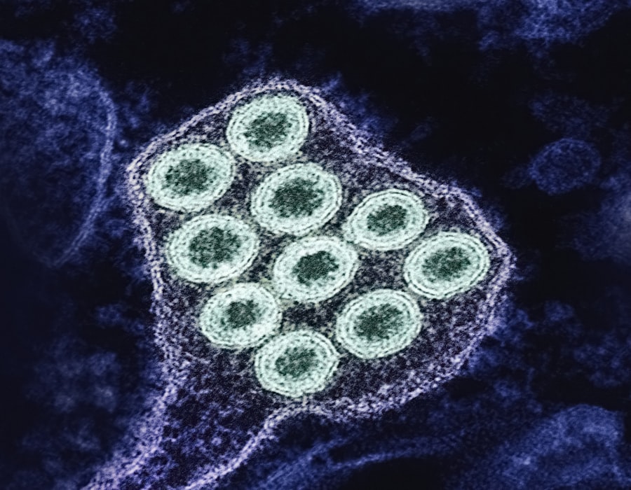Photo infectious diseases