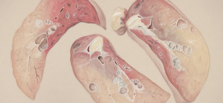 Photo endocrine diseases
