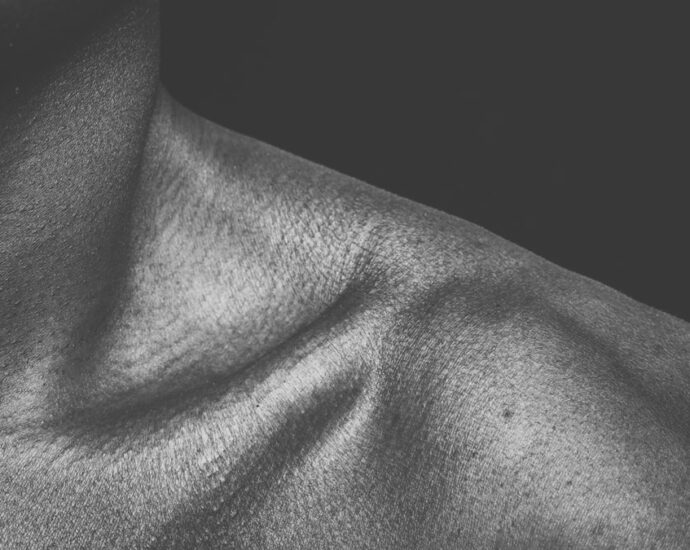 Photo thyroidism