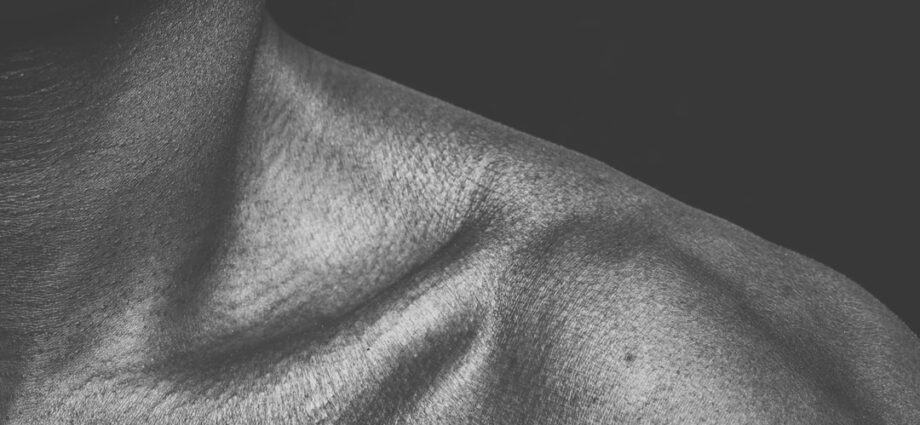 Photo thyroidism