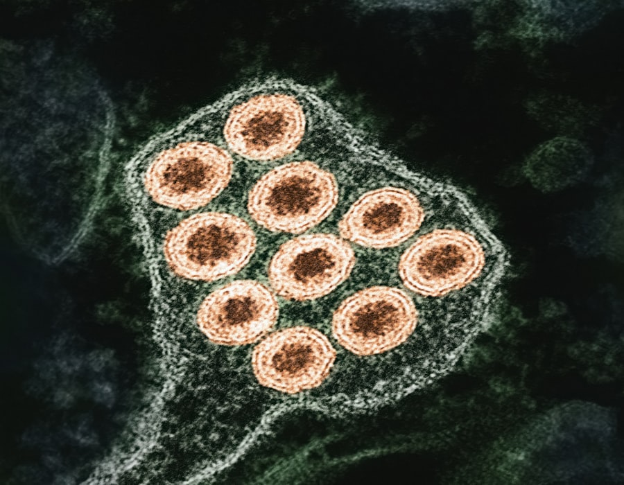 Photo diseases untreated