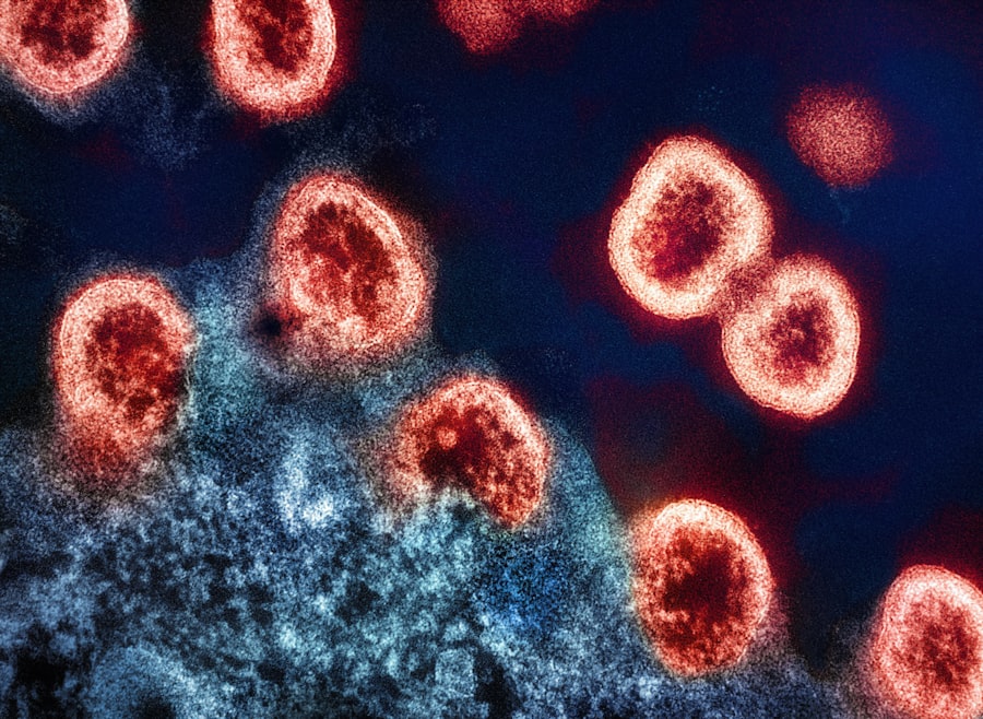 Photo hepatic diseases