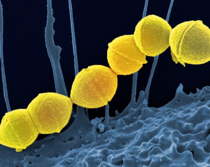 Photo urinary infections