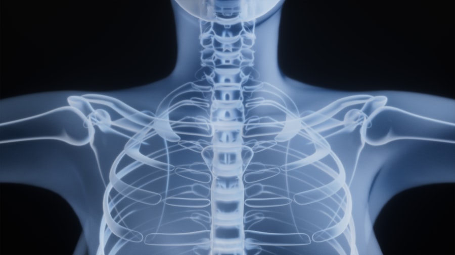 Photo thyroid diseases