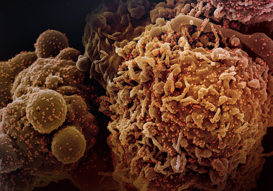 oncological diseases