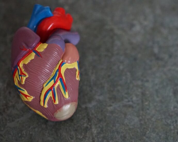 Photo cardiovascular symptoms