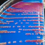 Photo early detection