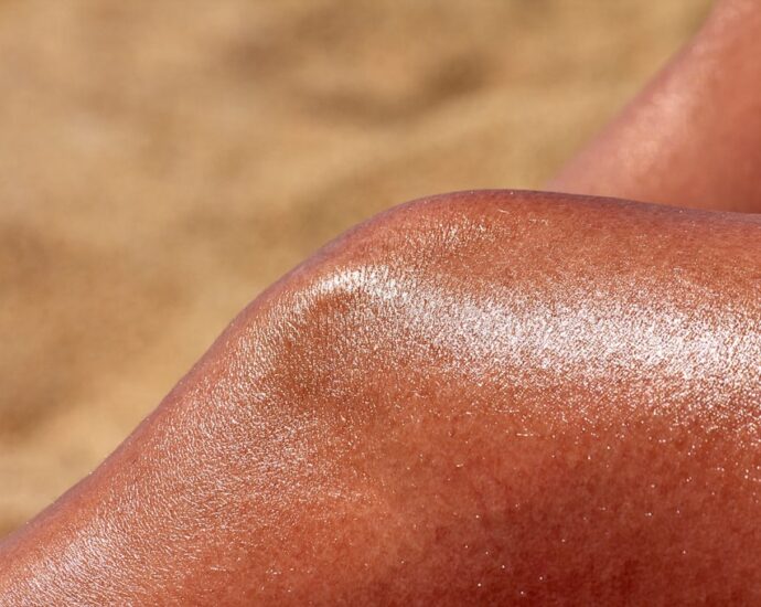 Photo skin diseases
