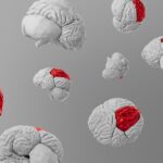 Photo neurodegenerative diseases