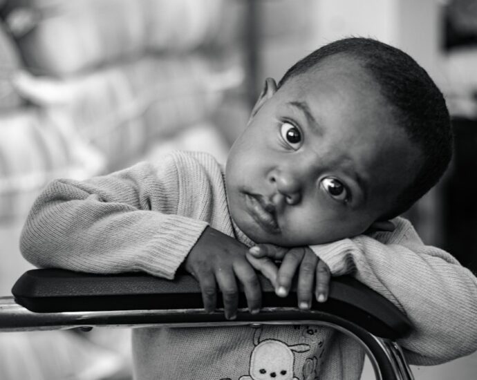 Photo Adaptation disorders