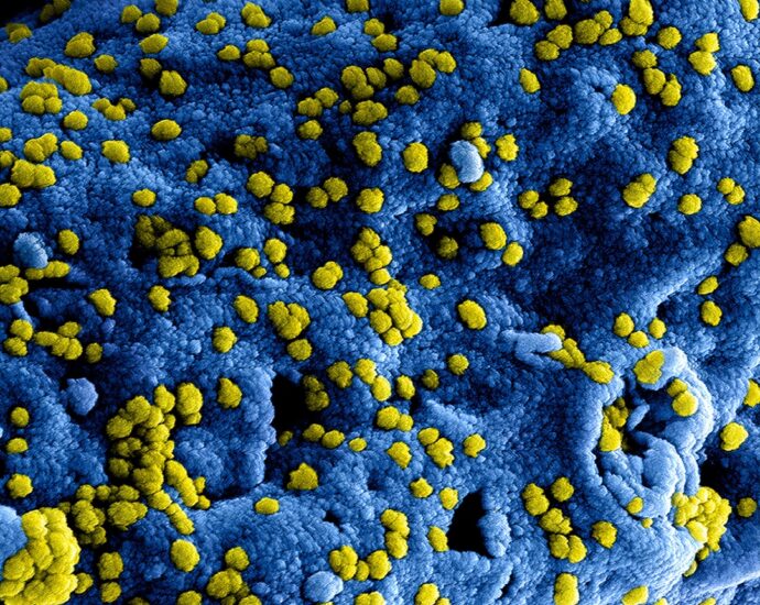 Photo allergies