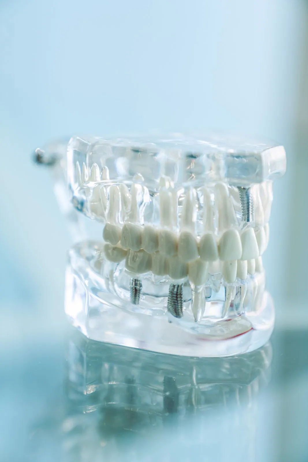 Medic stomatolog care explică pacientului riscurile unui implant dentar