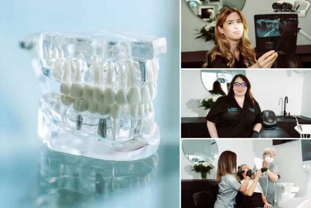 De ce poate eșua un implant dentar și ce poți face tu, după intervenție, ca să reduci riscul?