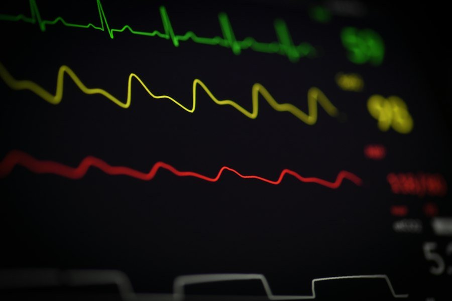 Photo cardiovascular disease prevention guide experts data