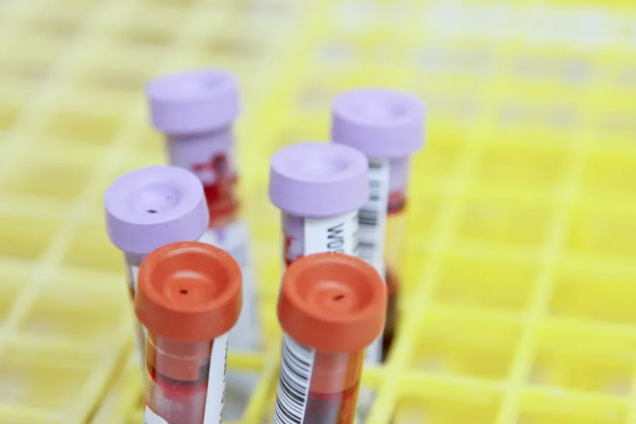 Photo common mistakes periodic medical tests